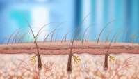 پتاسیل استفاده از MicroRNA ها برای القای رشد مو