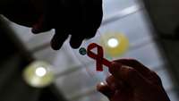 درمان زن مبتلا به HIV بعد از پیوند سلول های بنیادی برای اولین بار در جهان